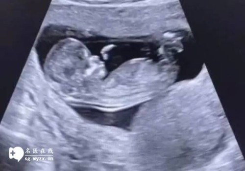 单身女性允不允许生育，利弊如何？