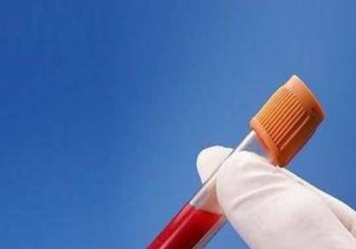 为什么不建议多囊卵巢患者去做试管，成功概率令人担忧